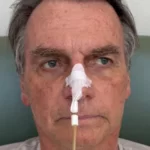 Bolsonaro deixa UTI e segue recuperação em quarto do hospital em Brasília