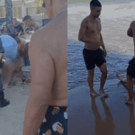 Vítimas de mordidas de tubarão seguem internadas em UTIs no Recife